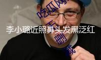 李小璐近照鼻頭發黑泛紅，43歲了還在尋求少女感，完全變成幼態臉